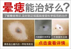 治疗晕痣最有效的方法