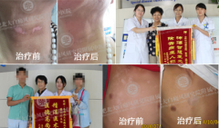 身上有白点怎么回事