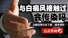  白癜风传染吗 