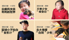 治疗白癜风最新方法,给