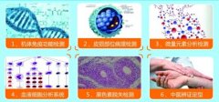 身上有白斑是怎么回事 
