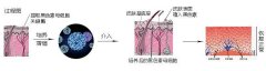 小孩得了白癜风能做黑色
