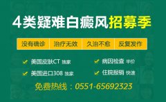 专家支招:如何花最少的