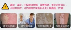 如何判定是早期白癜风?