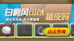  白癜风可以植皮吗 