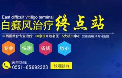  皮肤白斑怎么治疗 