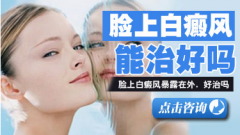  脸部有白斑怎么治疗 