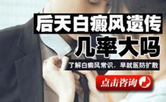 愁!白癜风会传染吗?
