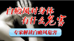 白癜风会扩散?如何避免