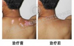 53岁父亲,在合肥北大“告