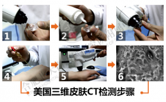 男性腿部白癜风康复实例