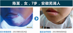 身上长的白斑会是什么病